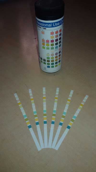 Urine Reagent Strips