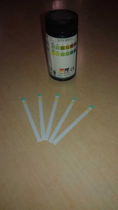 Urine Reagent Strips - Glucose & Protein